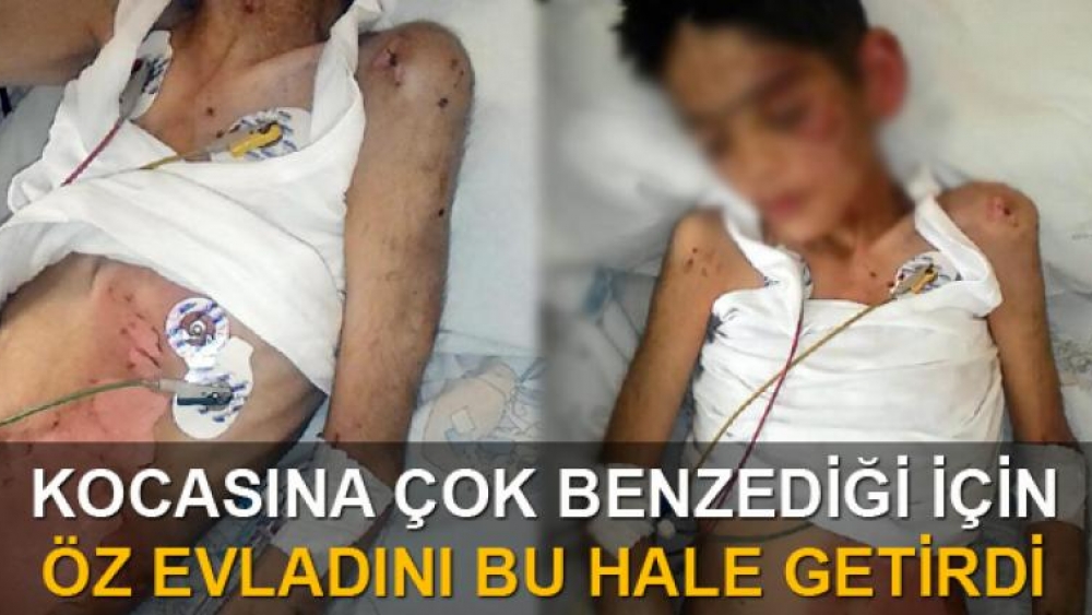 Öz oğluna işkence yapıp öldü diye hastaneye bıraktı