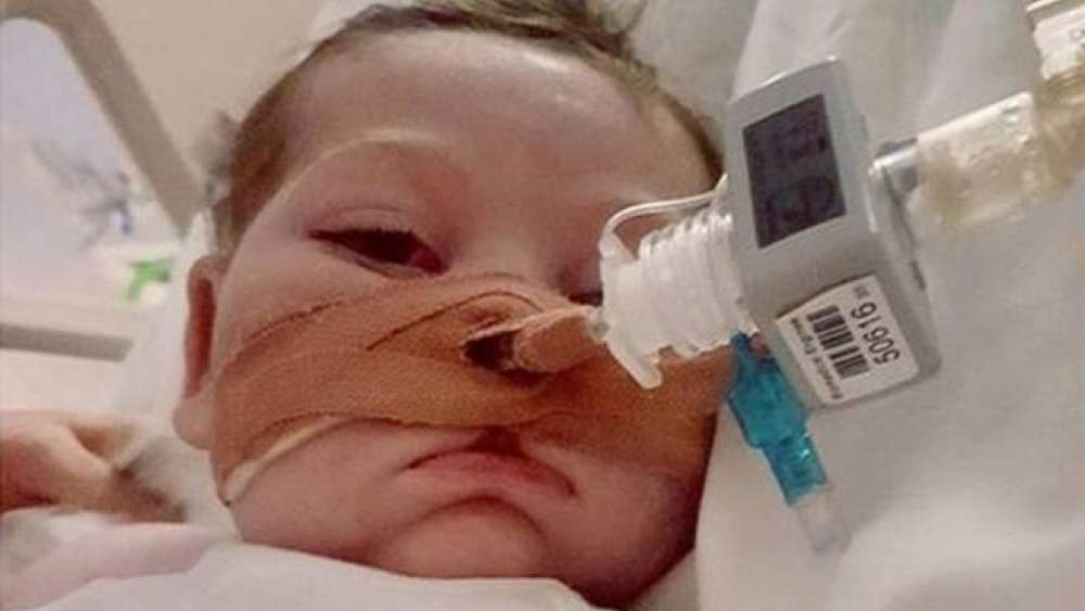 Charlie Gard: Annem oğlu fotoğrafı açık gözlerle paylaşıyor