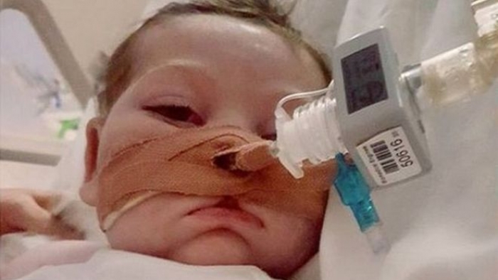 Charlie Gard: Annem oğlu fotoğrafı açık gözlerle paylaşıyor