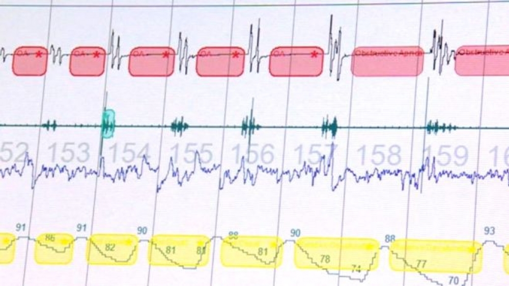 NHS tarafından uygulanan uyku bozukluğu testleri iki katına çıkar