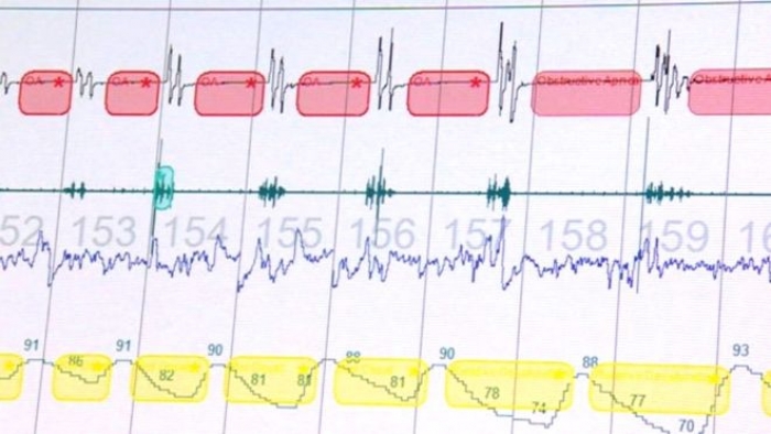 NHS tarafından uygulanan uyku bozukluğu testleri iki katına çıkar