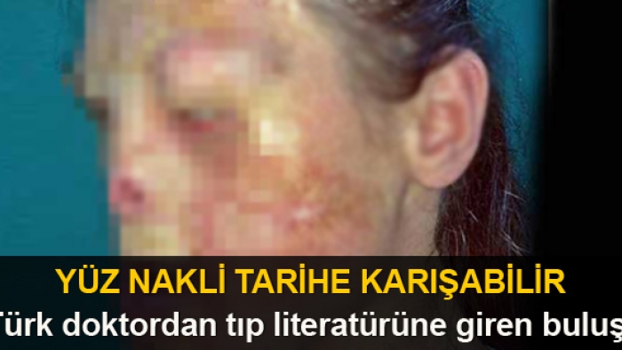 Türk doktordan tıp literatürüne giren buluş: Yüz nakli tarihe karışabilir